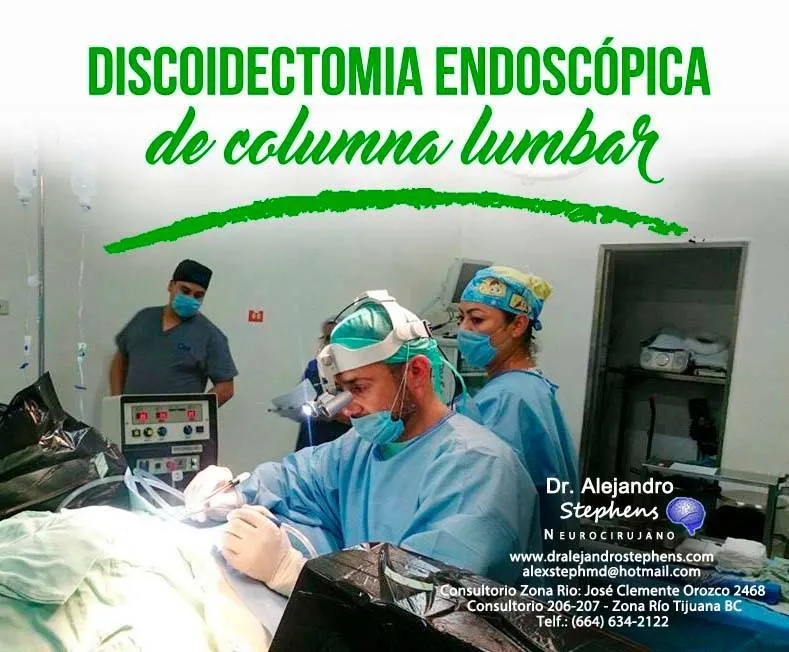 Discoidectomía Endoscopica Tijuana